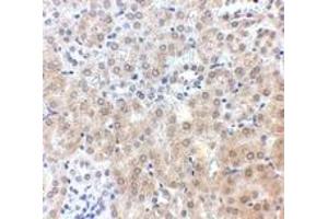 Immunohistochemistry (IHC) image for anti-Niemann-Pick Disease, Type C1 (NPC1) (C-Term) antibody (ABIN1030549)