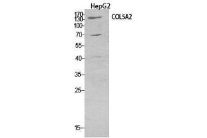 Western Blot (WB) analysis of HepG2 cells using COL5A2 Polyclonal Antibody. (COL5A2 antibody  (Internal Region))