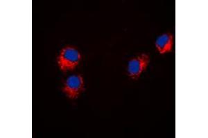Immunofluorescent analysis of Paxillin staining in Hela cells. (Paxillin antibody  (N-Term))