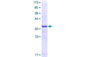 Metabotropic Glutamate Receptor 1 Protein (AA 387-486) (GST tag)