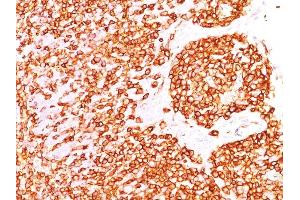 Formalin-fixed, paraffin-embedded human Tonsil stained with CD45RB Monoclonal Antibody (DF-B1). (CD45 antibody)