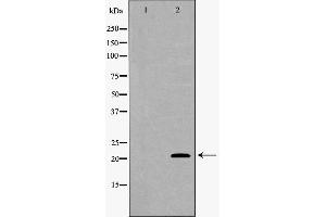 Western blot analysis of A549 whole cell lysates, using SFTPC Antibody. (Surfactant Protein C antibody  (N-Term))