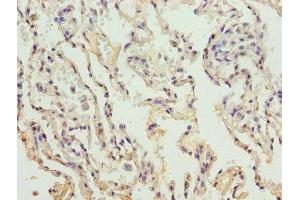 Immunohistochemistry of paraffin-embedded human lung tissue using ABIN7148251 at dilution of 1:100 (COL4a3 antibody  (AA 1427-1668))