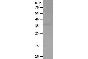 PARP2 Protein (AA 430-583) (His-IF2DI Tag)