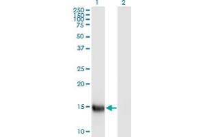 Western Blot analysis of SPEG expression in transfected 293T cell line by APEG1 monoclonal antibody (M01), clone S2. (SPEG antibody  (AA 1-113))