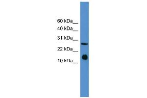 WB Suggested Anti-Il5 Antibody Titration: 0. (IL-5 antibody  (Middle Region))