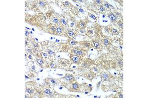 Immunohistochemistry of paraffin-embedded human liver injury using QARS antibody at dilution of 1:100 (x40 lens). (QARS antibody)
