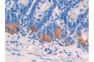 Detection of IL24 in Rat Intestine Tissue using Polyclonal Antibody to Interleukin 24 (IL24) (IL-24 antibody  (AA 29-183))