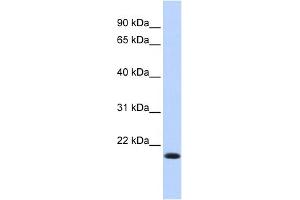 WB Suggested Anti-IRF7 Antibody Titration:  0. (IRF7 antibody  (N-Term))