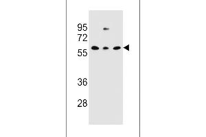 Western blot analysis in NCI-H460,293,MDA-MB231 cell line lysates (35ug/lane).