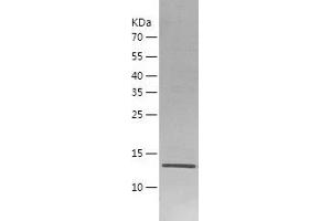 Western Blotting (WB) image for Fibroblast Growth Factor 22 (FGF22) (AA 23-170) protein (His tag) (ABIN7288911) (FGF22 Protein (AA 23-170) (His tag))