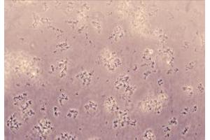 The activity of recombinant Human PRF1 Protein was observed with a hemolysis assay measuring lysis of rabbit erythrocytes (RaE). (Perforin 1 Protein)