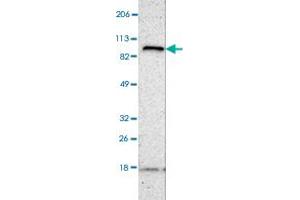 Western blot analysis of human cell line RT-4 with FANCB polyclonal antibody .