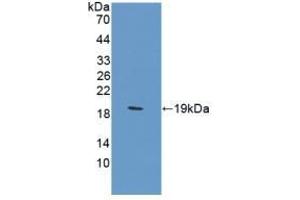 Detection of Recombinant CA12, Rat using Polyclonal Antibody to Carbonic Anhydrase XII (CA12) (CA12 antibody  (AA 154-307))