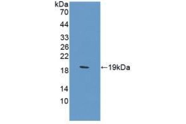 CA12 antibody  (AA 154-307)