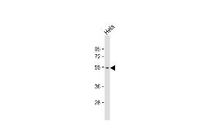 Anti-PKK5 Antibody  at 1:1000 dilution + Hela whole cell lysate Lysates/proteins at 20 μg per lane. (MAPKAP Kinase 5 antibody  (AA 160-189))
