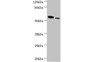 Western blot All lanes: RNF8 antibody at 11 μg/mL Lane 1: Hela whole cell lysate Lane 2: 293T whole cell lysate Secondary Goat polyclonal to rabbit IgG at 1/10000 dilution Predicted band size: 56, 11, 51 kDa Observed band size: 56 kDa (RNF8 antibody  (AA 1-260))