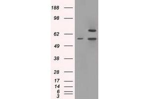 Image no. 2 for anti-Protein Phosphatase 5, Catalytic Subunit (PPP5C) antibody (ABIN1500391) (PP5 antibody)