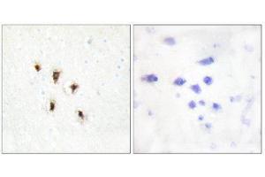 Immunohistochemistry (IHC) image for anti-Mevalonate Kinase (MVK) (Internal Region) antibody (ABIN1849535) (MVK antibody  (Internal Region))