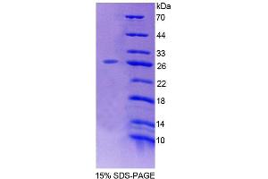 SDS-PAGE (SDS) image for Low Density Lipoprotein Receptor-Related Protein 1B (LRP1B) (AA 31-194) protein (His tag) (ABIN6239248) (LRP1B Protein (AA 31-194) (His tag))