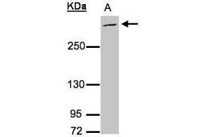 WB Image Sample (30μg whole cell lysate) A:Raji , 5% SDS PAGE antibody diluted at 1:3000 (MUC2 antibody  (C-Term))