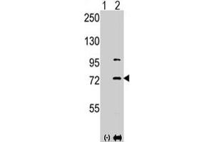 Western blot analysis of PAK1 (arrow) using PAK1 polyclonal antibody . (PAK1 antibody  (Thr423))