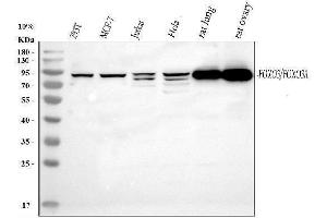 Western blot analysis of FOXO3A using anti-FOXO3A antibody (ABIN3042404). (FOXO3 antibody  (AA 471-673))