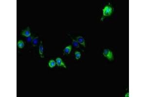Immunofluorescent analysis of Hela cells using ABIN7163856 at dilution of 1:100 and Alexa Fluor 488-congugated AffiniPure Goat Anti-Rabbit IgG(H+L) (GALNT11 antibody  (AA 420-606))