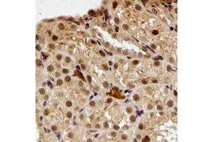 Immunohistochemical analysis of Periplakin staining in rat kidney formalin fixed paraffin embedded tissue section. (PPL antibody)