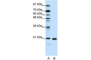 WB Suggested Anti-RPL9 Antibody Titration:  1. (RPL9 antibody  (C-Term))