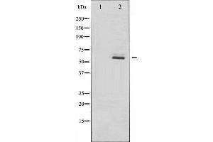 Western Blotting (WB) image for anti-Disabled Homolog 1 (Drosophila) (DAB1) (pTyr232) antibody (ABIN1843297) (DAB1 antibody  (pTyr232))