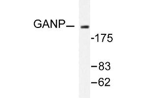 Image no. 1 for anti-Minichromosome Maintenance Complex Component 3 Associated Protein (MCM3AP) antibody (ABIN265431) (GANP antibody)