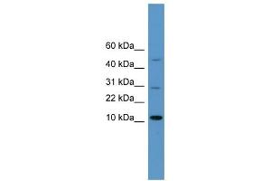WB Suggested Anti-HMGA1 Antibody Titration:  0. (HMGA1 antibody  (N-Term))