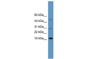 WB Suggested Anti-HMGA1 Antibody Titration:  0.