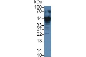Detection of CASP12 in Human Jurkat cell lysate using Polyclonal Antibody to Caspase 12 (CASP12) (Caspase 12 antibody  (AA 1-244))