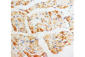 Anti-PMVK antibody, IHC(P) IHC(P): Rat Skeletal Muscle Tissue (PMVK antibody  (Middle Region))