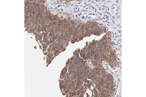 Immunohistochemical staining of human urinary bladder with PPFIBP2 polyclonal antibody  shows strong cytoplasmic positivity in urothelial cells at 1:50-1:200 dilution. (PPFIBP2 antibody)
