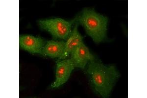 IF analysis of RNASEH1 and Tubulin beta using anti-RNASEH1 antibody (ABIN7602317) and anti-Tubulin beta antibody (ABIN7602744). (Ribonuclease H1 antibody  (AA 7-223))
