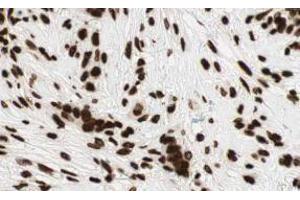 Image no. 2 for anti-GLI Family Zinc Finger 2 (GLI2) (AA 40-60), (AA 46-60), (Isoform alpha) antibody (ABIN401285) (GLI2 antibody  (Isoform alpha))