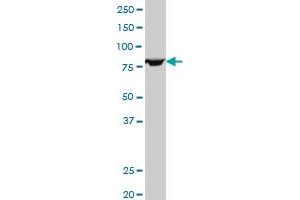 FOXP2 polyclonal antibody (A01), Lot # 050913JC01 Western Blot analysis of FOXP2 expression in HepG2 . (FOXP2 antibody  (AA 616-715))