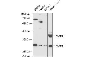 Western blot analysis of extracts of various cell lines, using KCNJ11 antibody (ABIN6129430, ABIN6142721, ABIN6142722 and ABIN6221442) at 1:1000 dilution.