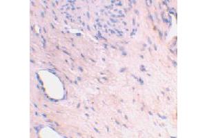 Immunohistochemical staining of human bladder tissue using ARL6IP1 polyclonal antibody  at 2 ug/mL .