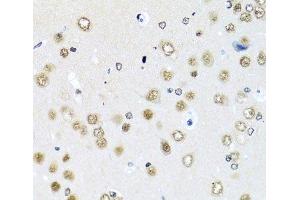 Immunohistochemistry of paraffin-embedded Rat brain using RAB3IP Polyclonal Antibody at dilution of 1:100 (40x lens). (RAB3IP antibody)