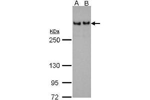 WB Image 53BP1 antibody [N1], N-term detects TP53BP1 protein by Western blot analysis. (TP53BP1 antibody  (N-Term))