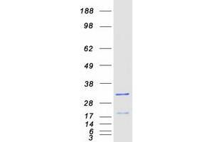 Validation with Western Blot