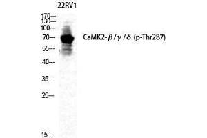 Western Blotting (WB) image for anti-CaMKIIbeta/gamma/delta (pThr287) antibody (ABIN3182661) (CaMKIIbeta/gamma/delta antibody  (pThr287))