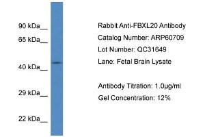 Western Blotting (WB) image for anti-F-Box and Leucine-Rich Repeat Protein 20 (FBXL20) (N-Term) antibody (ABIN2788548)
