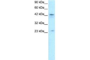WB Suggested Anti-ZNF365 Antibody Titration: 0. (ZNF365 antibody  (N-Term))