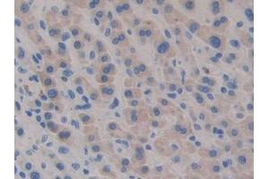 BPI antibody  (AA 140-250)