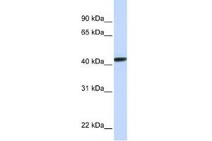 CLN8 antibody used at 1 ug/ml to detect target protein. (CLN8 antibody)